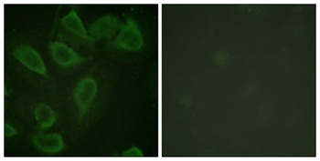 CD31 (phospho Tyr713) rabbit pAb