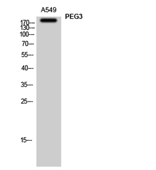 PEG3 rabbit pAb Antibody