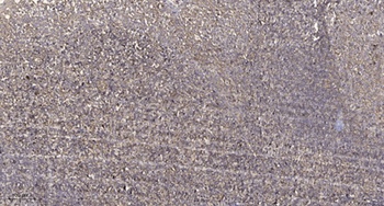 Prefoldin 1 rabbit pAb Antibody