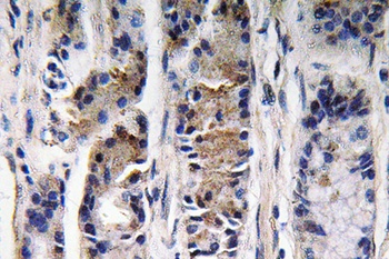 Pepsin C rabbit pAb Antibody