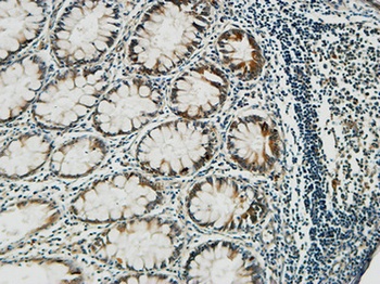 PGD rabbit pAb Antibody