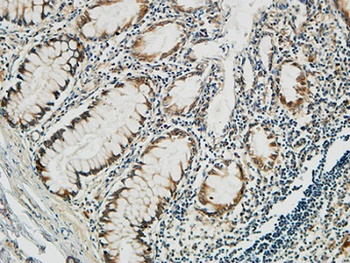 PGD rabbit pAb Antibody