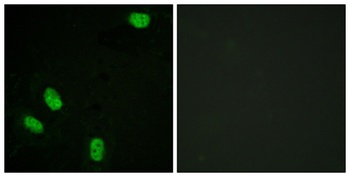 PR (phospho Ser294) rabbit pAb Antibody