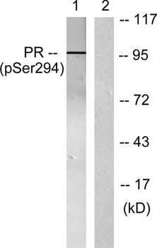 PR (phospho Ser294) rabbit pAb Antibody