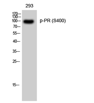 PR (phospho Ser400) rabbit pAb Antibody