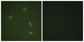 PR (phospho Ser400) rabbit pAb Antibody