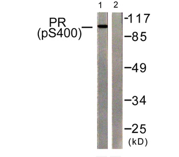 PR (phospho Ser400) rabbit pAb Antibody