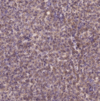 PI 3-kinase p85β (phospho Tyr464) rabbit pAb Antibody