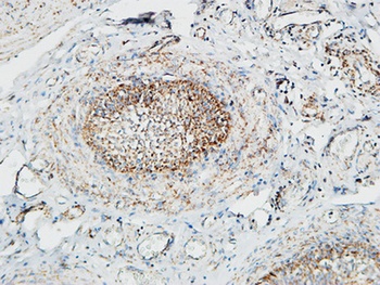 Pin1 rabbit pAb Antibody