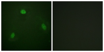 Pin1 rabbit pAb Antibody