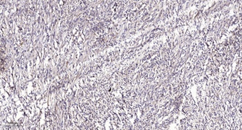 PKD2 (phospho Ser812) rabbit pAb Antibody