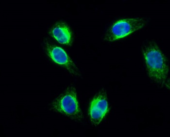 cPLA2 (phospho Ser505) rabbit pAb Antibody