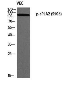 cPLA2 (phospho Ser505) rabbit pAb Antibody