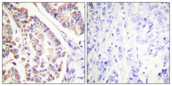 cPLA2 (phospho Ser505) rabbit pAb Antibody