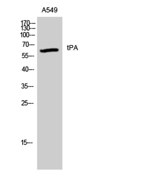 tPA rabbit pAb Antibody