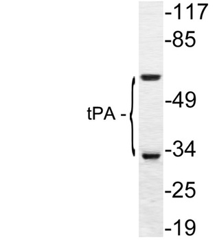 tPA rabbit pAb Antibody
