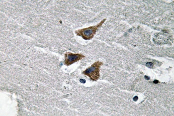 uPA rabbit pAb Antibody