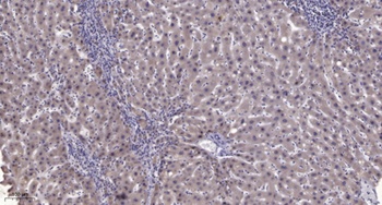 PC-PLD1 (phospho Thr147) rabbit pAb Antibody