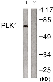 Plk rabbit pAb Antibody