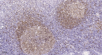 Plk rabbit pAb Antibody