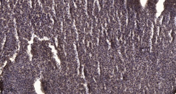 PLB (phospho Ser16/T17) rabbit pAb Antibody