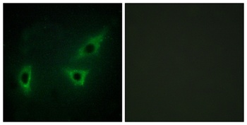 ATP7B rabbit pAb Antibody