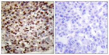 Histone H2B (Acetyl Lys15) rabbit pAb Antibody