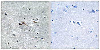 CYTL1 rabbit pAb Antibody
