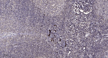 POLR2J1 rabbit pAb Antibody