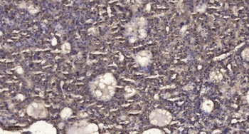 RIAM rabbit pAb Antibody