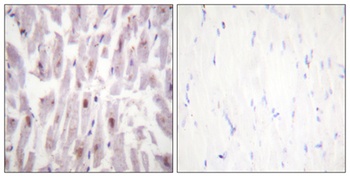 TRAP220 (phospho Thr1457) rabbit pAb Antibody