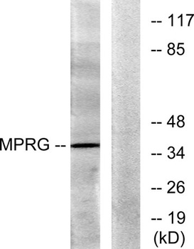mPRγ rabbit pAb Antibody