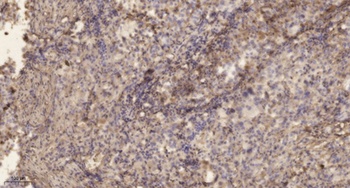 ELOVL2 rabbit pAb Antibody