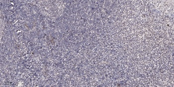 PinX1 rabbit pAb Antibody