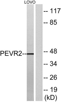 GPR172B rabbit pAb Antibody