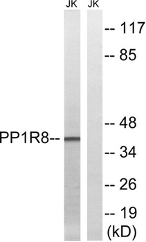NIPP1 rabbit pAb Antibody