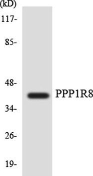 NIPP1 rabbit pAb Antibody