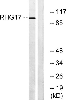 ARHGAP17 rabbit pAb Antibody