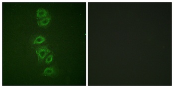 PP2A-Cα (phospho Tyr307) rabbit pAb Antibody