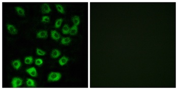 ARF GAP1 rabbit pAb Antibody