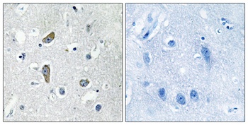 CDK5 Activator-binding C48 rabbit pAb Antibody