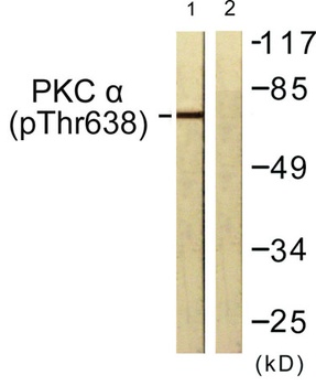 PKC α (phospho Thr638) rabbit pAb Antibody