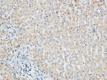 PKC α rabbit pAb Antibody