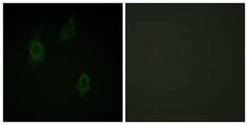 PKC (phospho Thr497) rabbit pAb Antibody