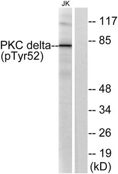 PKC δ (phospho Tyr52) rabbit pAb Antibody