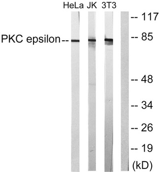 PKC ε rabbit pAb Antibody