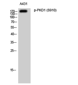PKD1 (phospho Ser910) rabbit pAb Antibody