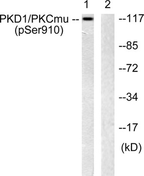 PKD1 (phospho Ser910) rabbit pAb Antibody
