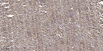 PKD1 (phospho Ser910) rabbit pAb Antibody