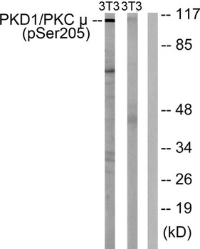 PKD1 (phospho Ser205) rabbit pAb Antibody